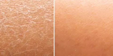 Beneficios del agua de mar para la piel -canalSALUD